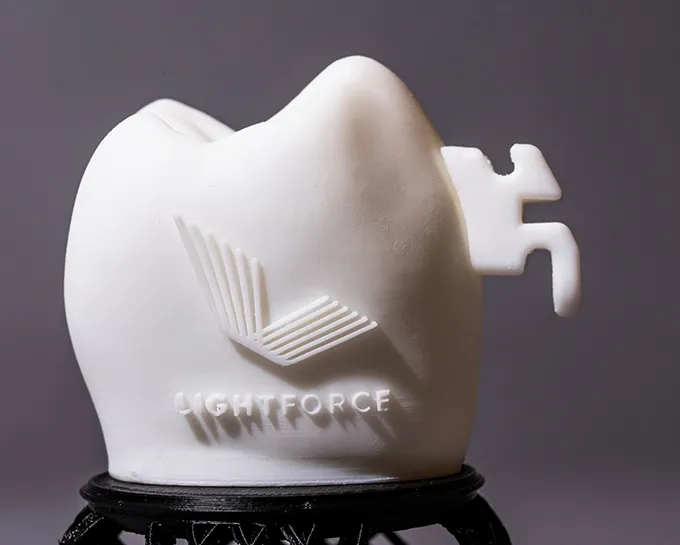 LightForce digital orthodontic treatment in Gilbert, AZ