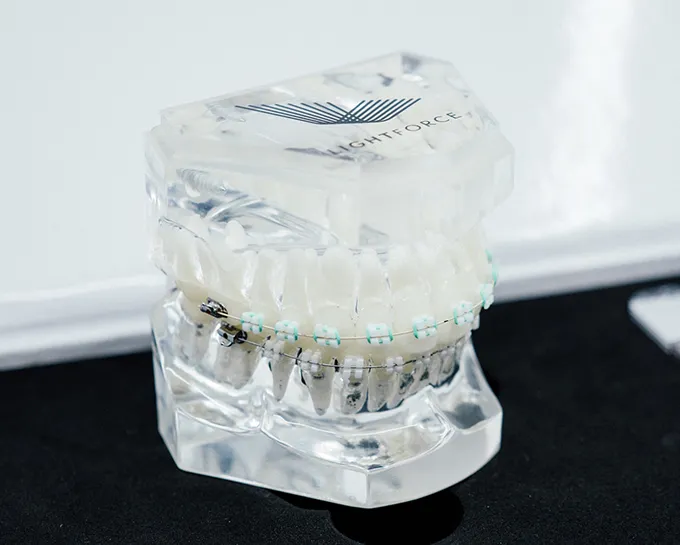digitalorthodontic treatmentplanning at Larson Family Orthodontics in Gilbert, AZ